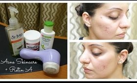 Acne skincare + Retin A ♥ | July 2015