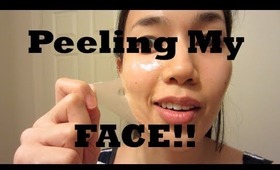 PEELING my FACE!