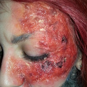 Special Effects burn practice. For more images and updates visit and like my Facebook www.facebook.com/emilyjaynemakeup