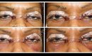 Blepharoplasty/ Eyelid Surgery/ Ethnic /African American ~ Part 2
