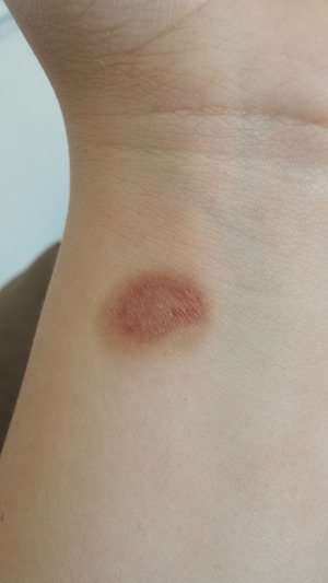 Burn Mark From Curling Wand :\ | Beautylish