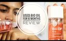 Bio Oil Review _ Does Bio Oil Work on Stretch Marks & Scars? | SuperWowStyle