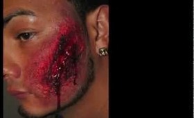 Opened Burned Wound Tutorial