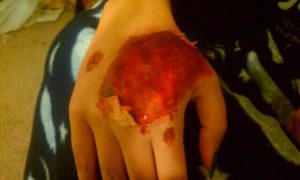 My friend found out she has a flesh eating virus. One of my first SFX tries