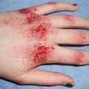 Bloodied Hands