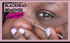 CHEAP INSTANT BLACKHEAD REMOVER -SATISFYING EXTRACTION & PIMPLE POPPING!