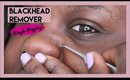 CHEAP INSTANT BLACKHEAD REMOVER -SATISFYING EXTRACTION & PIMPLE POPPING!