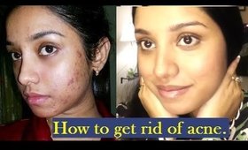 How I got rid of my acne + skin care routine.