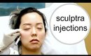 NON SURGICAL FACELIFT FOR JOWLS USING SCULPTRA INJECTIONS