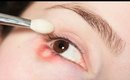 Why You Have To Wash Makeup Brushes | Eye Infection/Stye