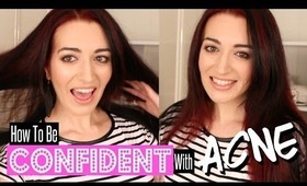 How To Be CONFIDENT When You Have ACNE!