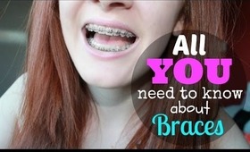 All About Braces!