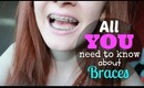 All About Braces!