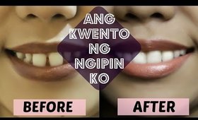 ANG KWENTO NG NGIPIN KO (PAANO BA NAAYOS?) | thelatebloomer11