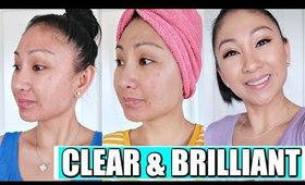 Laser Away Clear & Brilliant Review | Laser Facial for Acne, Scars, Wrinkles, Large Pores, Texture