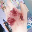 open Wounds