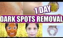 How To Remove Dark Spots On Face | 1 Day Skincare Routine For Spotless Skin |SuperPrincessjo