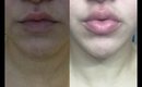 MyLipz  Lip Enhancer Review and Demo -How to plump your lips